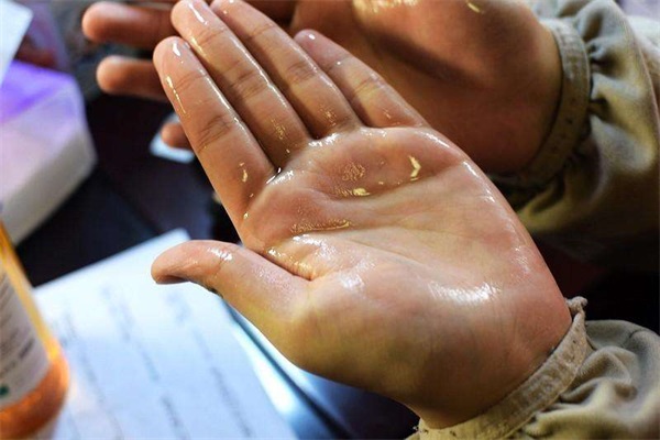 免洗手凝胶价格 免洗手凝胶价格